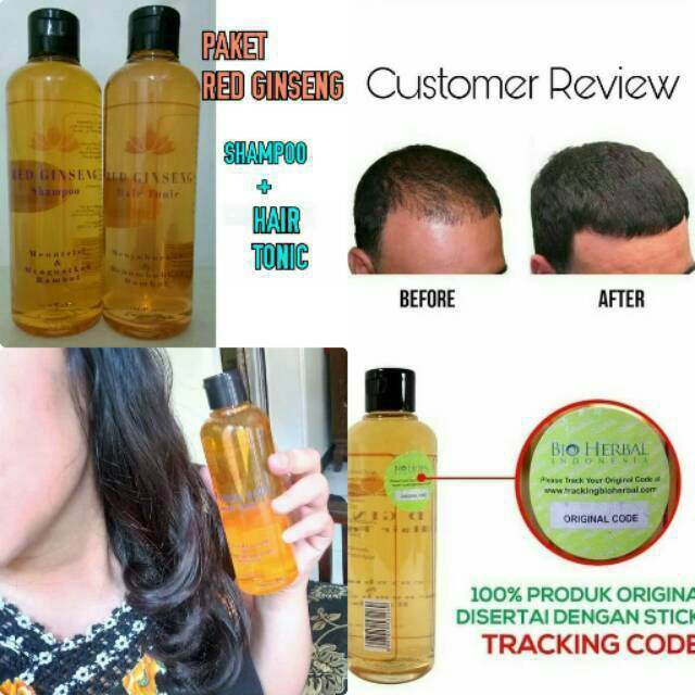 Takarai Shampo Penebal Rambut AMPUH Mengatasi Rambut Rontok dalam 7 Hari | Red Ginseng Shampoo BPOM