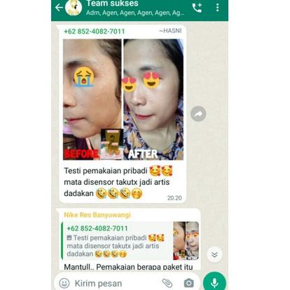 M7W5 DINITA SKINCARE PAKET FORTE ORI + SERUM