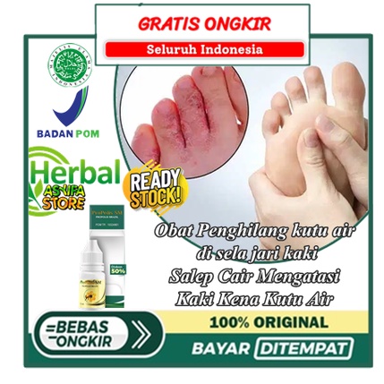Obat Penghilang kutu air di sela jari kaki, Salep Cair Mengatasi Kaki Kena Kutu Air, Herbal Menghila
