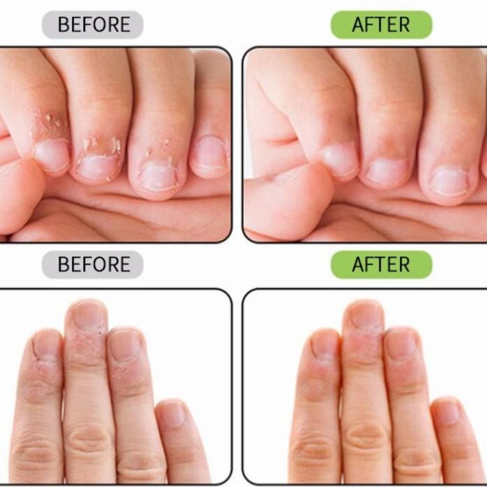 Terlaris Anti Ngenyot Jempol/Gigit Jari/Hisap Jempol (Seperti Mavala Stop) Kualitas Terbaik