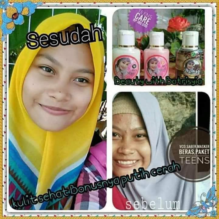 Paket Teens Care Batrisyia Herbal (Day Cream, Night Cream, Toner)