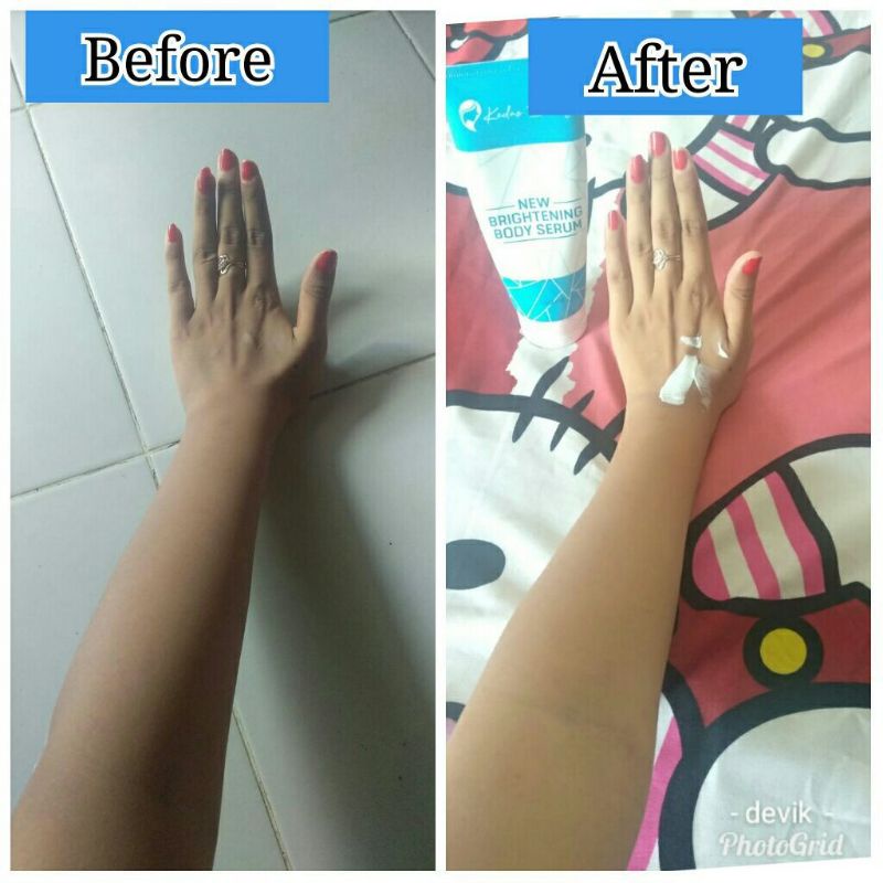 LOTION PEMUTIH BODYSERUM KEDAS BEAUTY