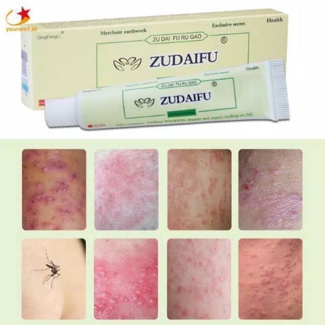 ZUDAIFU SALEP EKSIM OBAT CINA GATAL ORIGINAL SALEP PSOARISIS ROSACEA ANTI BAKTERI