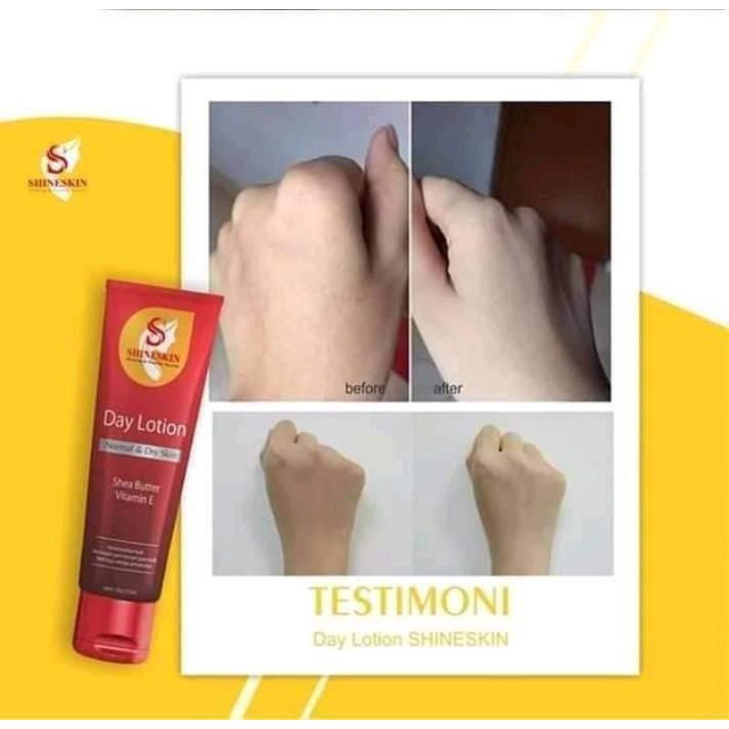 Pemutih seluruh tubuh tanpa suntik pemutih secara permanen