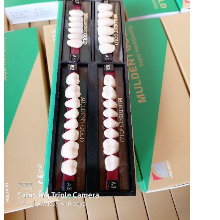 ✪ GIGI MULDENT GOLD FULL SET ►