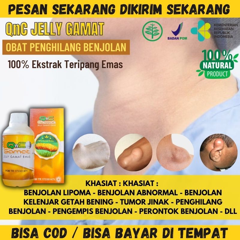 QnC JELLY GAMAT Sembuhkan Tumor Benjolan - Herbal Tumor Jinak dan Ganas - Tumor Otak - Tumor Payudar