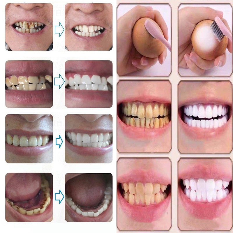 Pasta Gigi pemutih Pemutihan Gigi penghilang plak Gigi ajaib baking soda tooth paste Mencerahkan Gigi Dan Karang Gigi ORIGINAL 100%