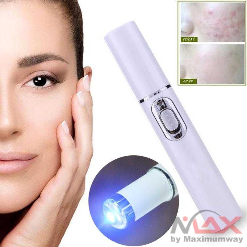 Laser Pembunuh Kuman dan Bakteri untuk muka Berjerawat, Perawatan Muka berjerawat, AMPUH membunuh kuman di jerawat Pen LED Biru Laser Penghilang Jerawat Acne Treatment Acne Laser Pen Portable Wrinkle Removal Machine Durable Blue Light Therapy Massage