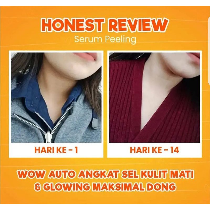 PEELING SERUM 10 ML MS GLOW BARKODE BPOM.