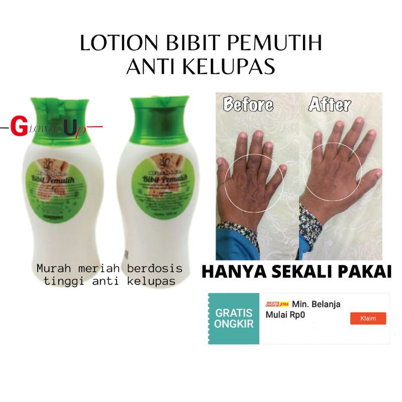 SYB Whitening Lotion Bibit Pemutih Badan Permanen - Body Whitening - Perawatan tubuh