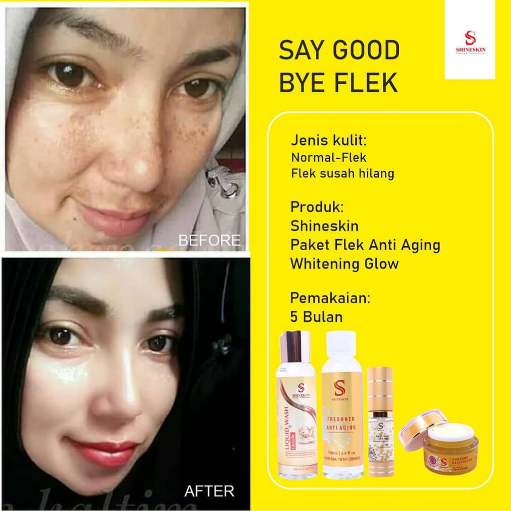 Serum Flek bintik hitam SHINESKIN
