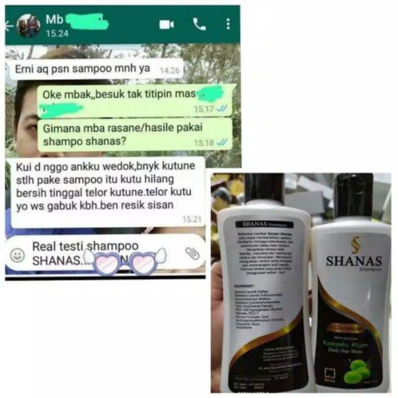 SHAMPO KUTU RAMBUT - SHAMPO SHANAS - SAMPO KUTU RAMBUT - SAMPO SANAS -Shampoo Shanas Nasa (Cegah dan Pembasmi Kutu Rambut) Cegah Rambut Lepek Rontok Ketombe