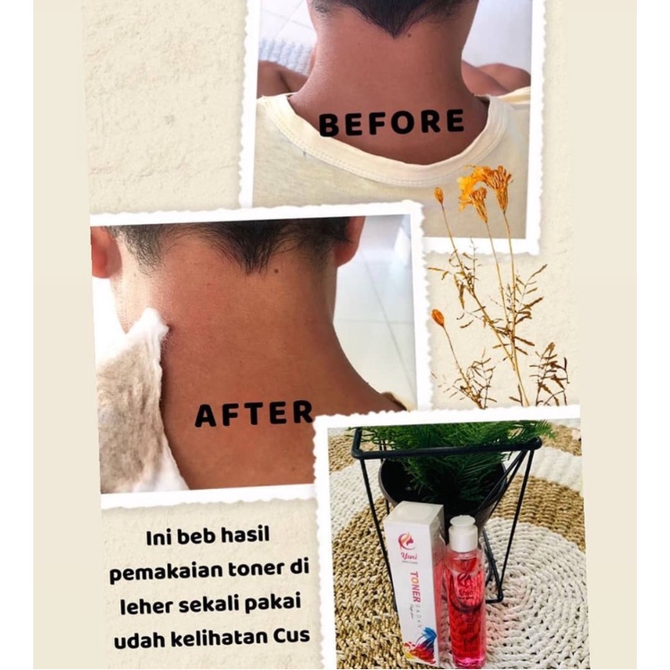 TONER BADAN PENGHILANG DAKI | YONI SKINCARE TONER BADAN 100ML BPOM