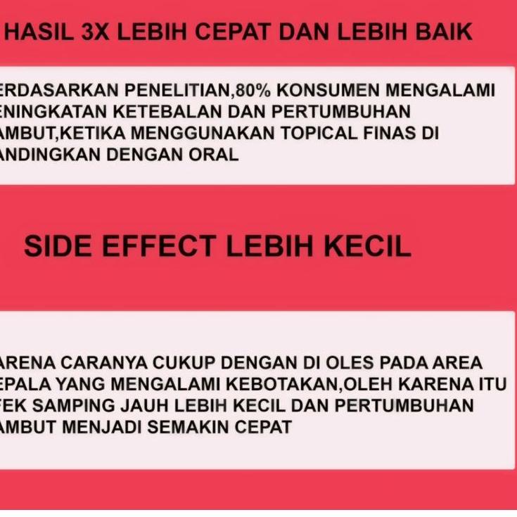 Awas Barang Tiruan Finmix minoxidil mix h73➱