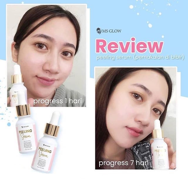 MS GLOW Peeling Serum MS Glow Original Terbaru