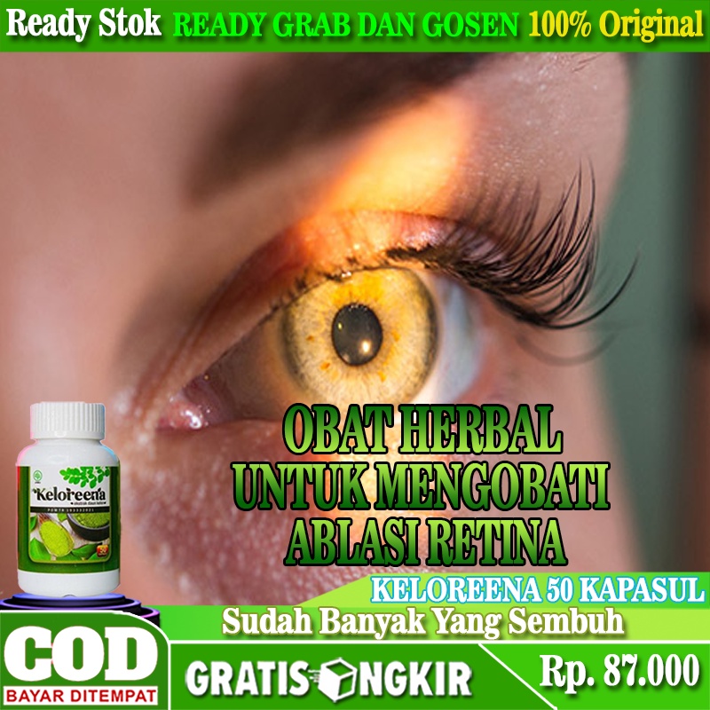 Obat Ablasi Retina, Obat Ablasio Retina, Obat Gangguan Retina Ablasi Retina / Retina Mata Rusak, Oba