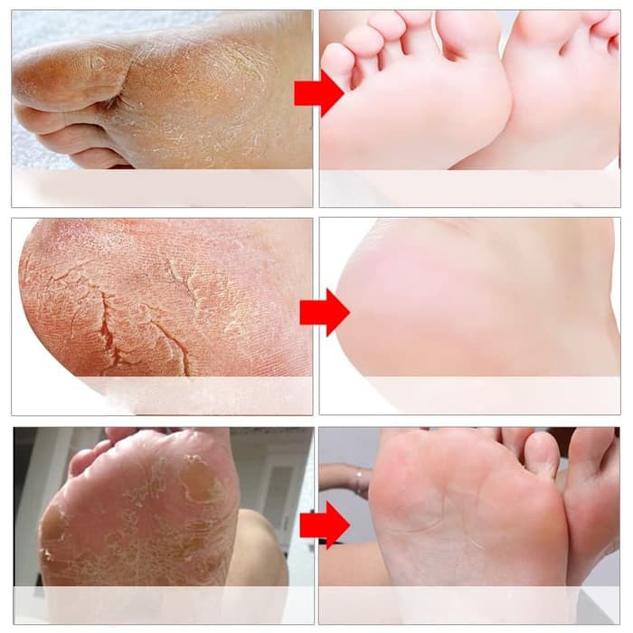 Masker Efero foot mask penglupas kulit kaki kering menghaluskan Telapak kaki pecah pecah