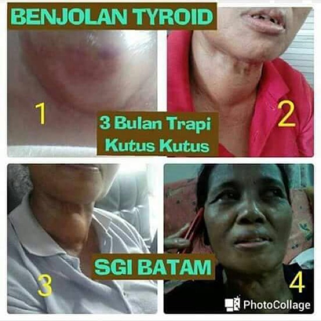 35+ Meme Uang Obat Segala Penyakit