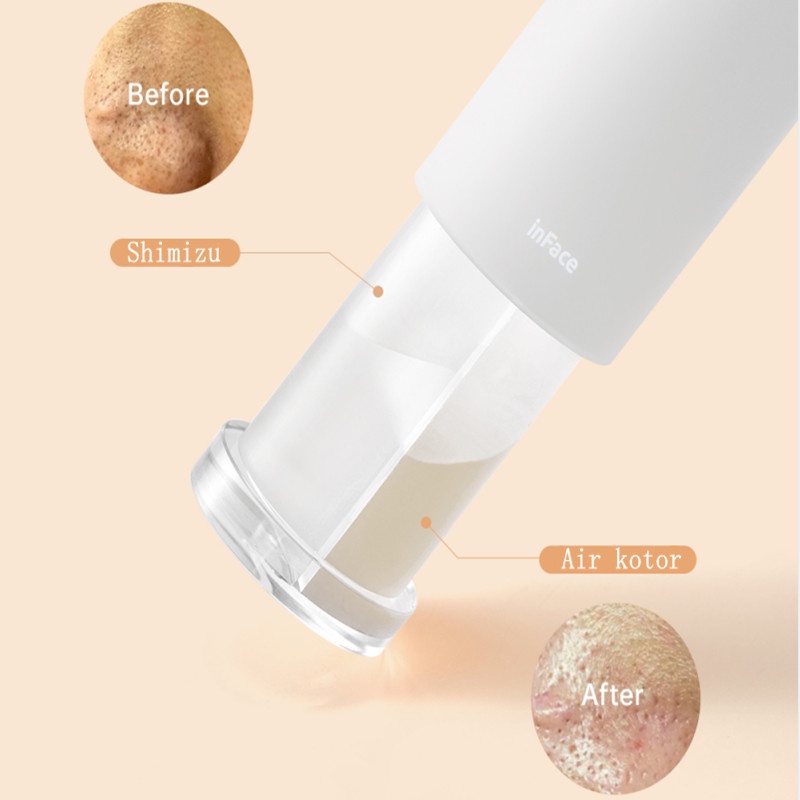 inFace Facial Alat Pembersih Komedo 40°C Suhu Konstan SPA Instrumen Perawatan Kulit Kecantikan Tiga Kepala Hisap Electric Acne Clean Blackhead Black Point Vacuum Negatif Sirkulasi Air Tekanan Wajah Penuh Aqua Peel Termal Perangkat Wajah CF-07E