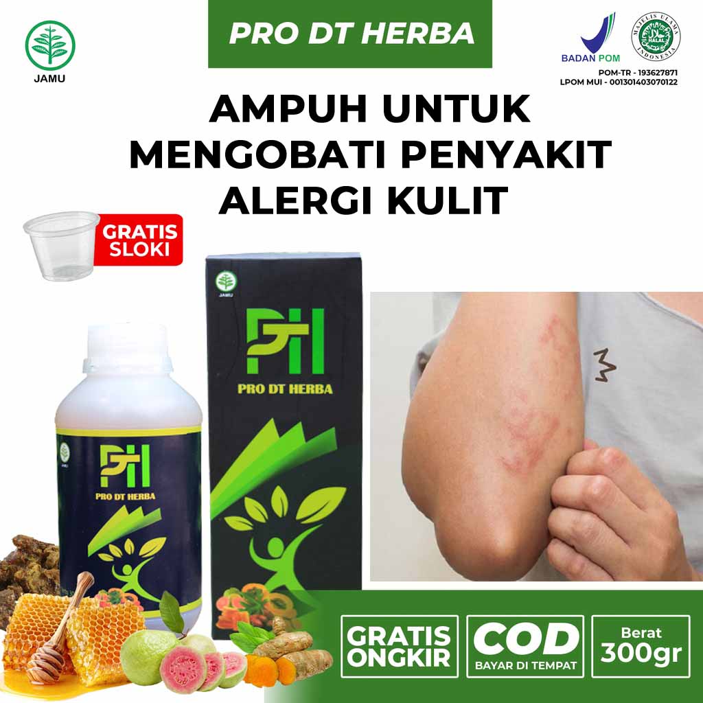 Obat Alergi Gatal Kulit Paling Ampuh, Alergi Dingin Flu Batuk Pilek Debu Anak Dewasa, Alergi Hidung 
