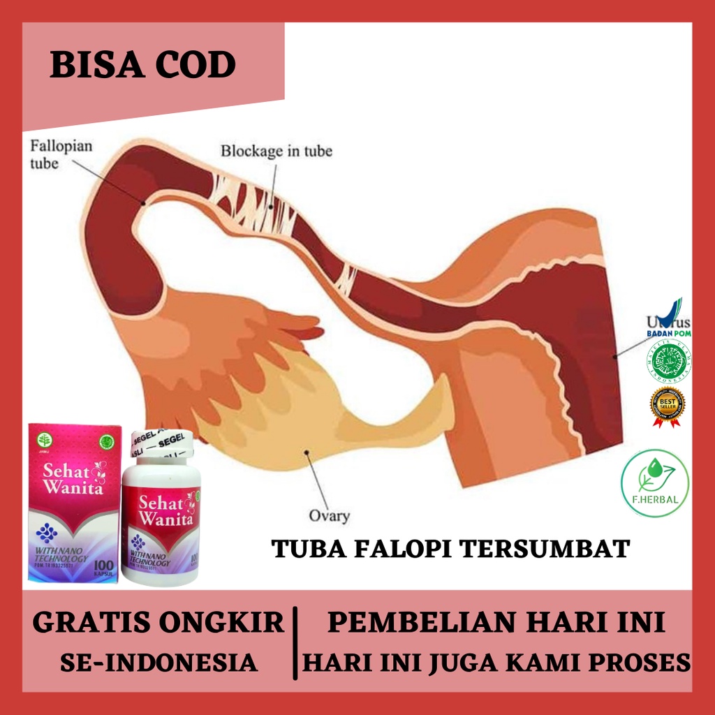 Obat Tuba Falopi Tersumbat, Obat Penyumbatan Tuba Falopi, Obat Penyumbatan Saluran Tuba Falopi, Obat