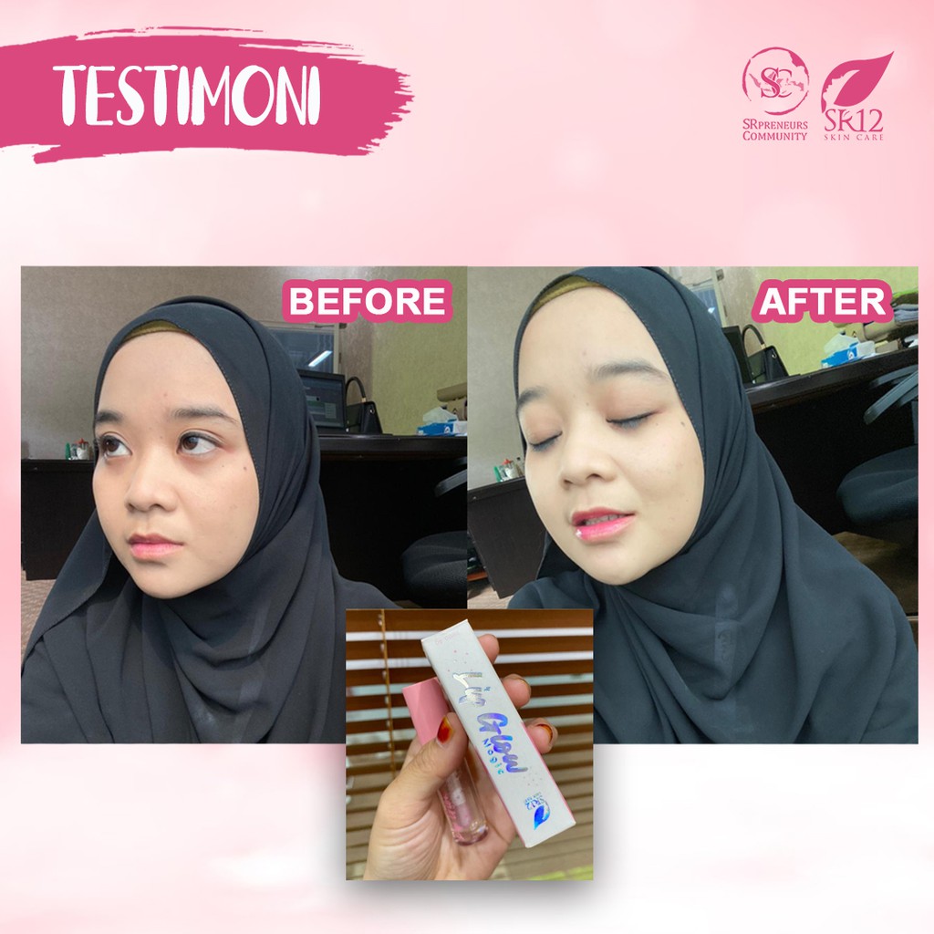 LIP GLOW MAGIC SR12 / LIP GLOSS SERUM BIBIR SR12 HERBAL SKINCARE / LIPSTIK &amp; PELEMBAB BIBIR ALAMI /SERUM BIBIR BPOM / PEMERAH BIBIR ORIGINAL AMAN