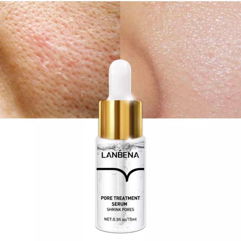 LANBENA PORE TREATMENT SERUM UNTUK MENGECILKAN PORI-PORI MENGURANGI KEKERINGAN MENGONTROL MINYAK BERLEBIH MENGENCANGKAN WAJAH HALUS LEMBUT-15ml