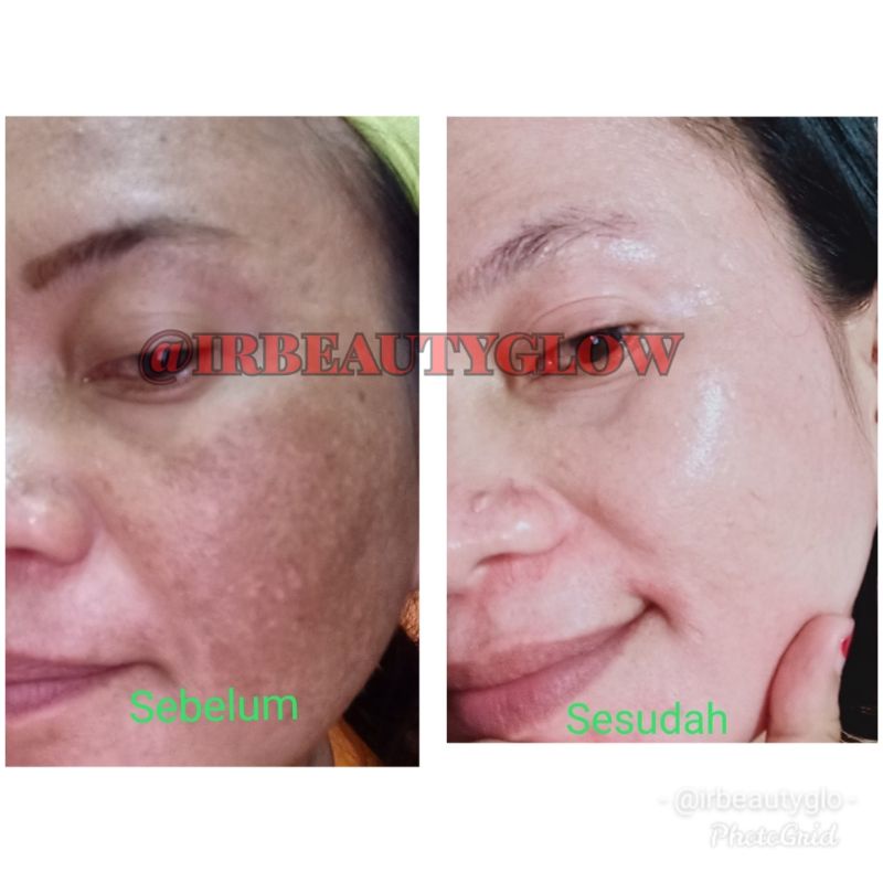 Platinum glow by Irbeautyglow cream pemutih wajah cream pemutih ampuh perawatan wajah skincare perawatan wajah perawatan kecantikan cream glowing perawatan kecantikan cream pemutih cream flek bandel pemutih wajah