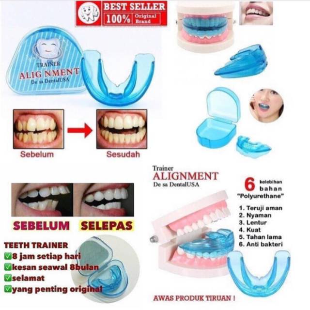 Teeth trainer alignment Usa