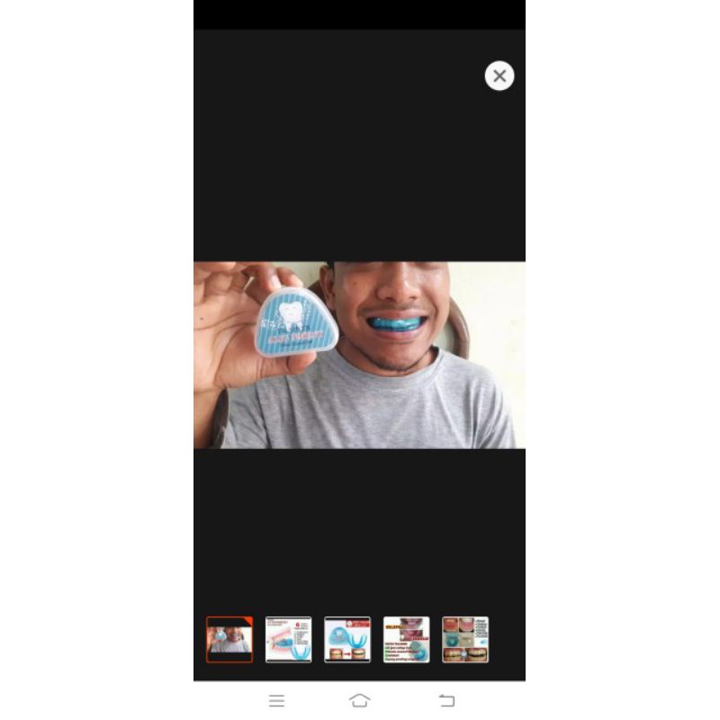 behel lepas pasang