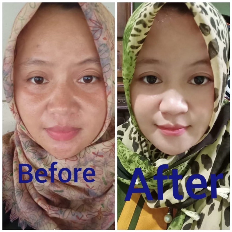 MS Glow Whitening Day Cream GIRLSNEED77 Krim Siang Pelembab Mencerahkan Wajah