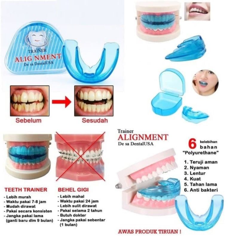 Teeth Trainer Alignment Orthodentic Alat Perapi Gigi Lepas Pasang Made In USA - Alat Perapih Gigi Tanpa Kawat Behel