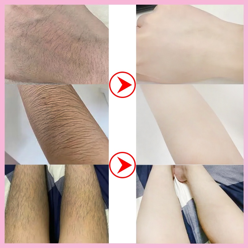 【Barang spot】Semprotkan cream Krim penghilang ​bulu encabutan rambut tanpa rasa sakit Ketiak, bulu kaki, jenggot,lengan,Dada,bagian pribadi hair removal spray Ringan dan tidak mengiritasi penghilang bulu permanen enghilang rambut cepat yang aman, lembut