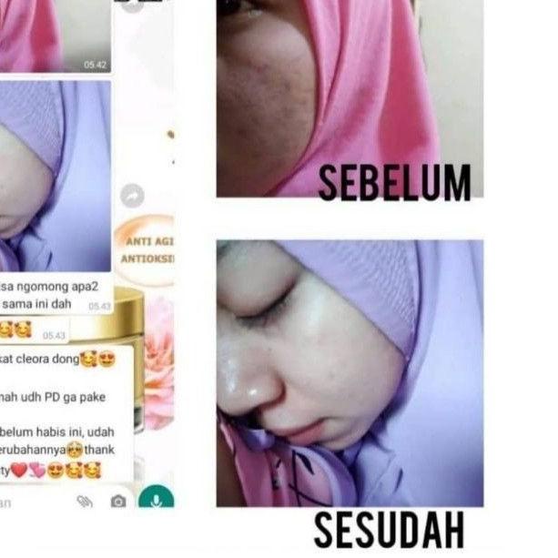 ● [PROMO] CLEORA BEAUTY JELLY BOOSTER ORIGINAL ❊