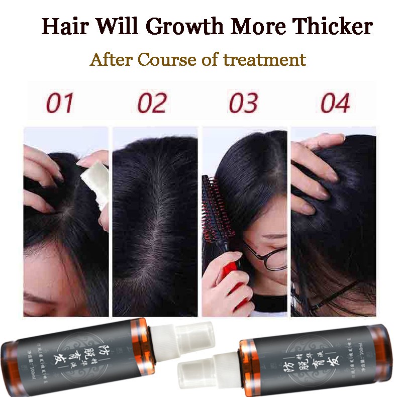 Minyak Penumbuh Rambut Botak Dan Rontok Essence Anti Rontok Mempercepat Pertumbuhan Rambut Pria Anak Bayi Balita -100ml