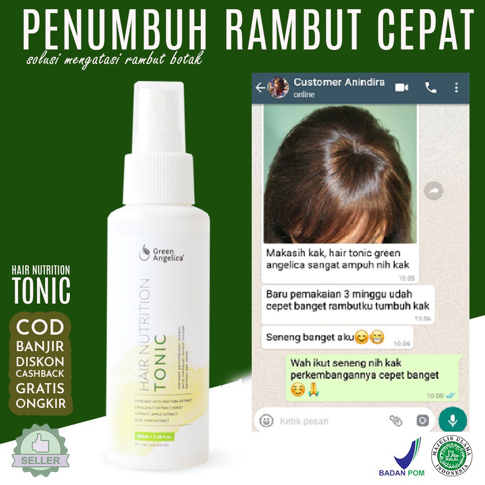 Hair Tonic Cara Menumbuhkan Rambut Dari Penipisan Dan Kerontokan Shopee Indonesia