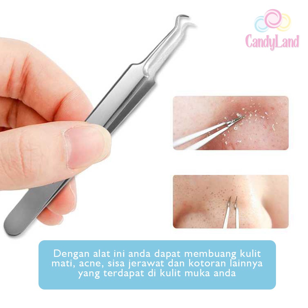 Set Alat Pencabut Komedo Pinset Pencetan Jerawat Pembersih Blackhead Stainless 3 Pcs