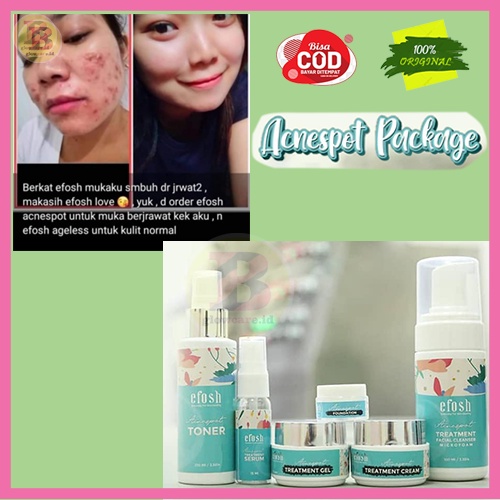 Skincare acnespot efosh penghilang mengatasi jerawat original