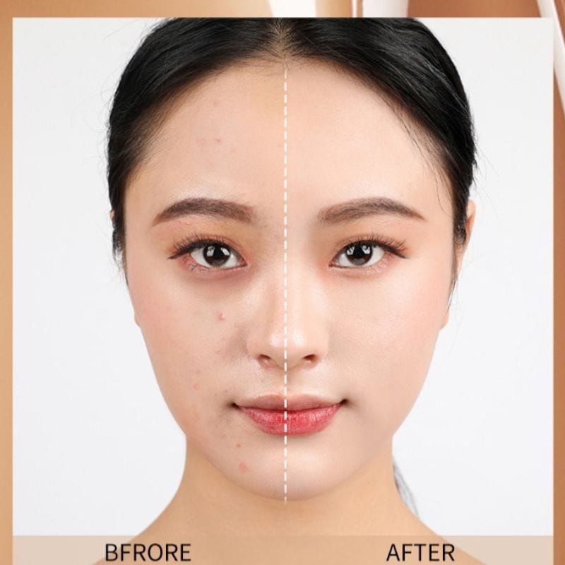 MEDAN TERMURAH LIGHT CREAM SEPARATION CONCEALER REPAIR LAMEILA