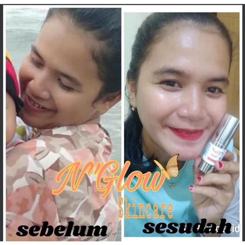 Serum N'Glow Skincare Pemutih Wajah 100% BPOM ORI Aman Terampuh