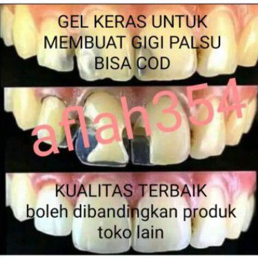 TEMPTOOTH,GEL UNTUK MEMBUAT GIGI PALSU/MENAMBAL GIGI BOLONG/BISA JADI LEM GIGI PALSU