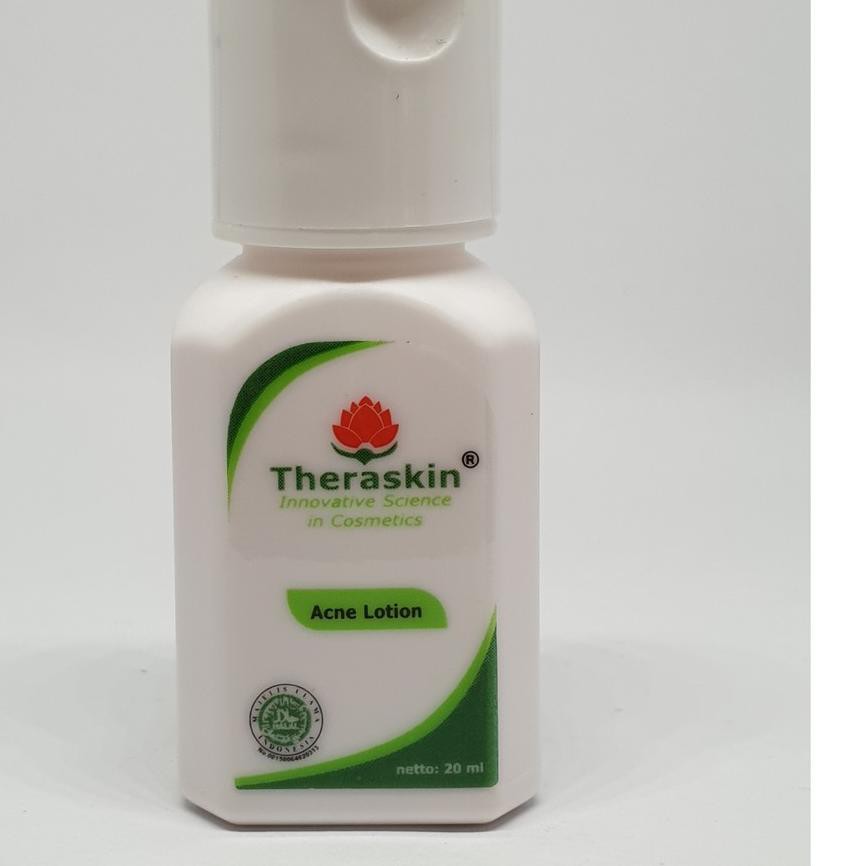 acne lotion terbaik