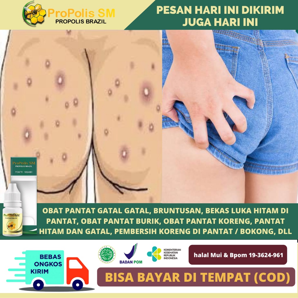 Obat Pantat Gatal Gatal, Bruntusan, Bekas Luka Hitam di Pantat, Obat Pantat Burik, Obat Pantat Koren