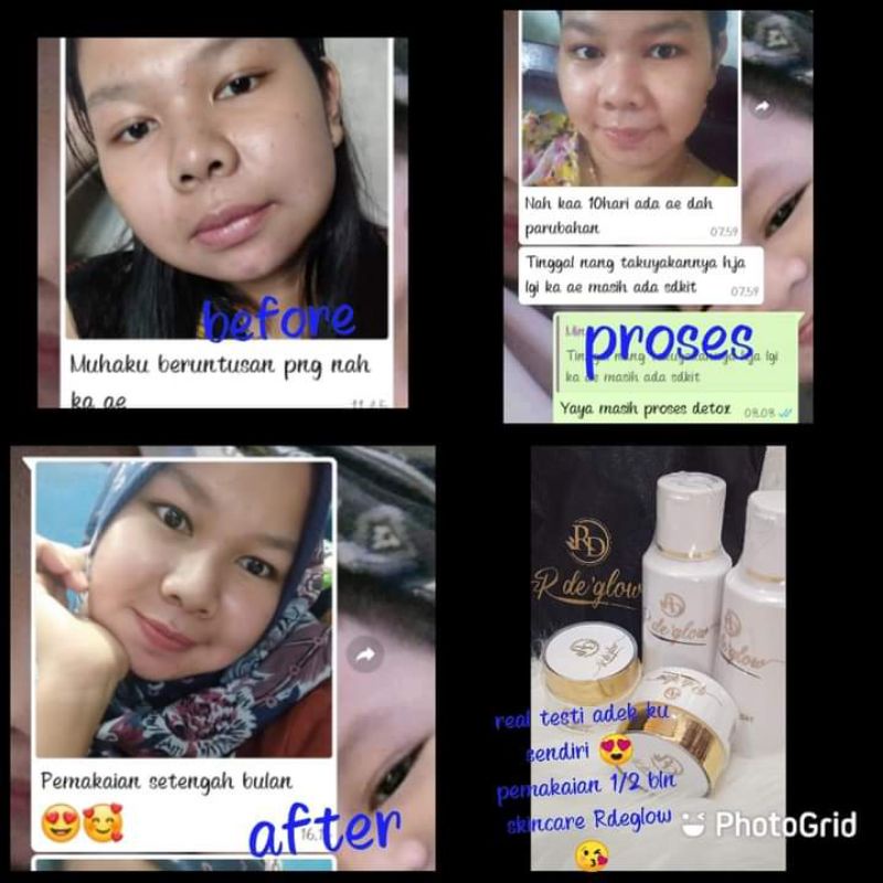 Rinna Diazella - RD GOLD - RDE' GLOW