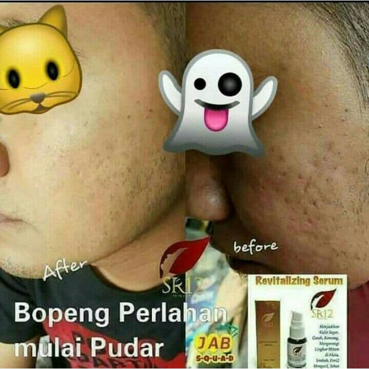 REVITALIZING SERUM / SERUM WAJAH / SERUM BOPENG / saudagarsr12