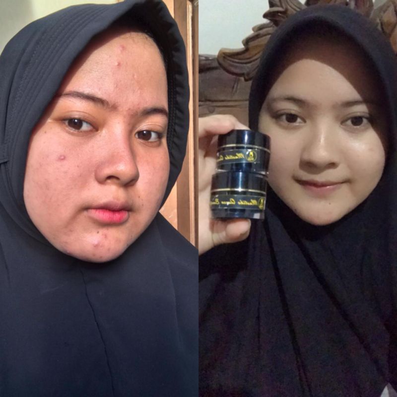PAKET MQBeauty Brightening Series [free red jelly + cream jerawat] Skincare BPOM - MQ Beauty Krim Perawatan Wajah [Bayar Ditempat] [Asli] [Original] [Cod]-2