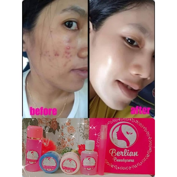 BERLIAN BEAUTYCARE WHITENING EXPRESS