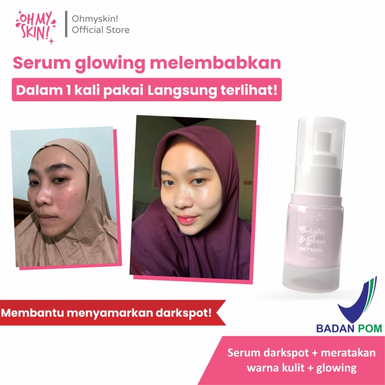 Oh My Skin! Bright & Glow SERUM pencerah melembabkan memudarkan bekas jerawat