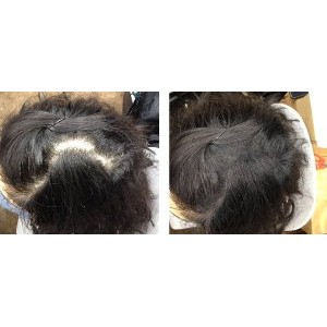 Promo OCARE HAIR BUILDING FIBER REFILL 57g HITAM Murah