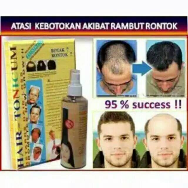 Original Obat Penumbuh Rambut Hairtonicum Obat Penumbuh Rambut Botak